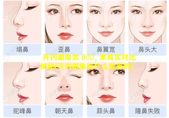 开内眼角效 🕸 果真实对比揭秘(开内眼角有什么危害吗)